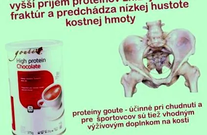 osteoporoza