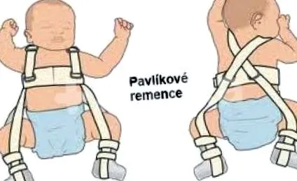 PAVLIK REMOVE