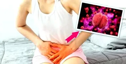gonorrhoea