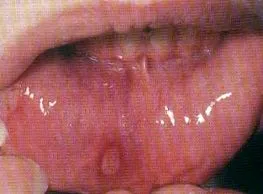 рани abcdent