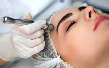 microdermabrazie