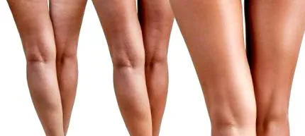 bellesa