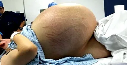 súlyos olyan