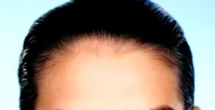 elmondja