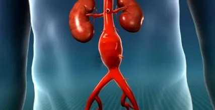 este aorta