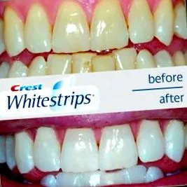 Crest Whitestrips