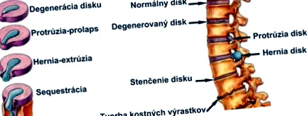 vertebrale coloanei