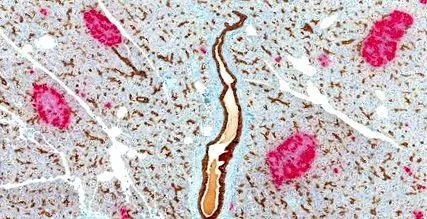 insulele insulele