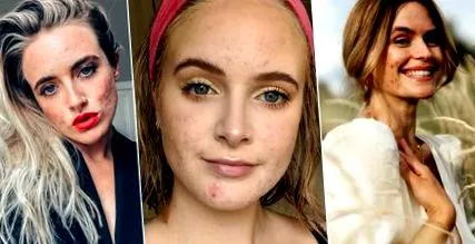 este