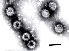 rotavirus