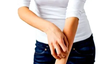 psoridex