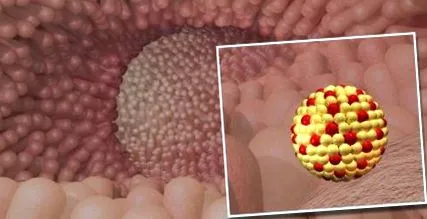 tehnologia intestinului subțire