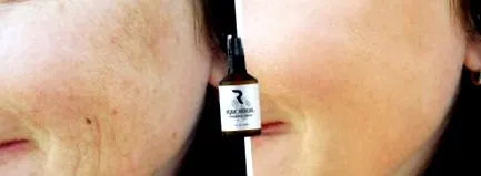 anti-îmbătrânire Rechiol rechiol