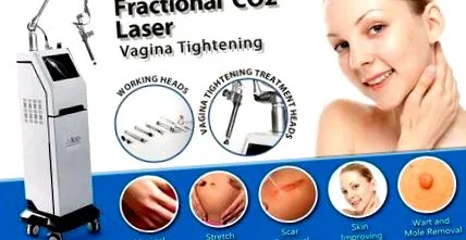 vaginal laser