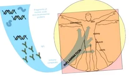 eritematos sistemic