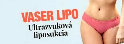 vaser