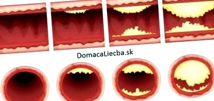 arterele care