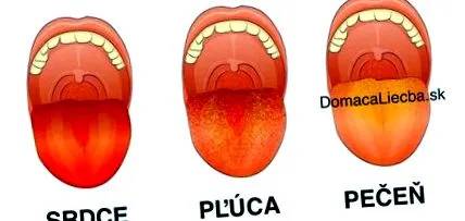care limba