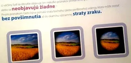 lipsească vedere
