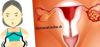 ovarian