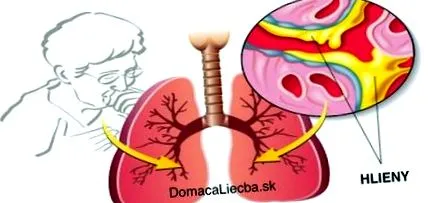 mucus mucus