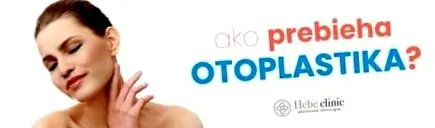 otoplastie funcționează