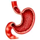 gastropatie