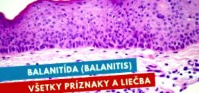 лечение