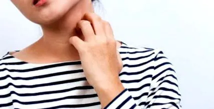 psoriazis psoriazis