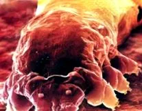 demodex
