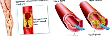 boala piciorul