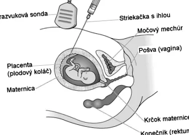 pentru care