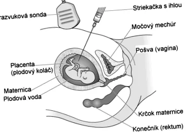 copilul dumneavoastră eurogentest