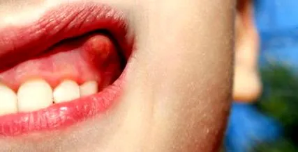 dental schill