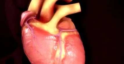 tetralogie