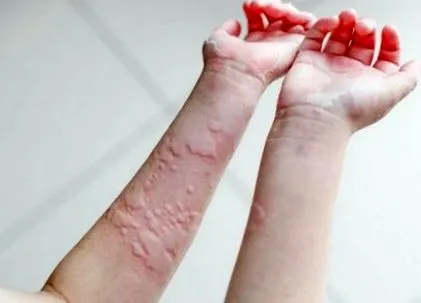 este