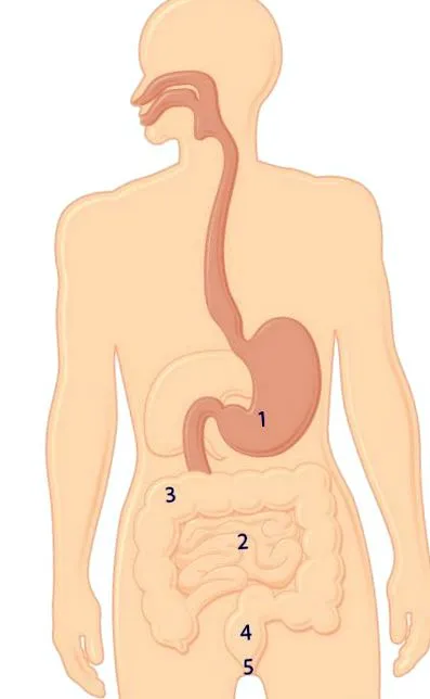 colostomie