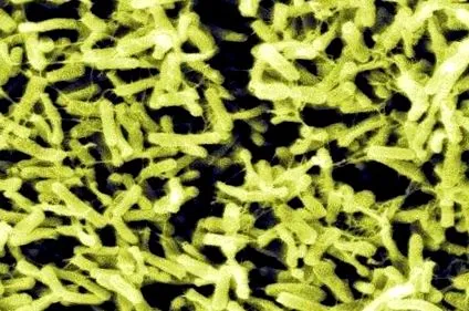 infecții