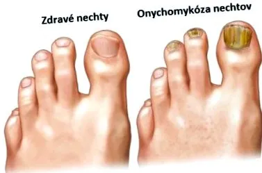 împotriva împotriva