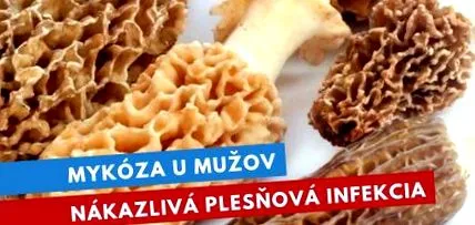 micoza Micoza bărbați