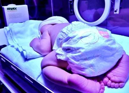 neonatal departamentul