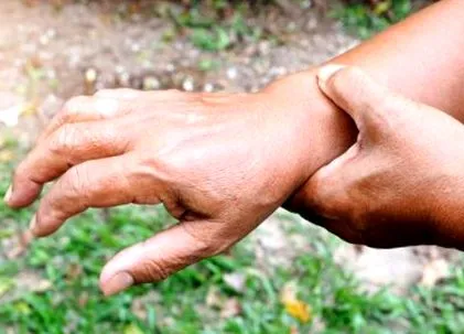 articulare articulare