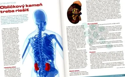 gyógyszerrel kezelni