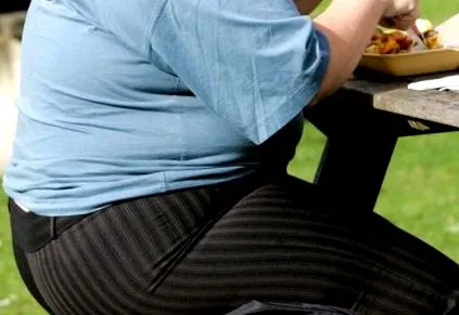 obezității