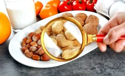 alimentare alergii