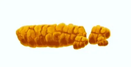 aggódni