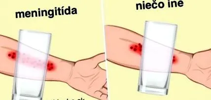 salva