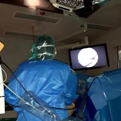 arthroscopy-kezelés