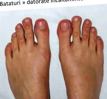 lábujjak