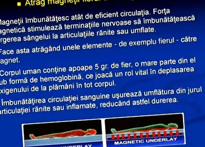 vasízületek